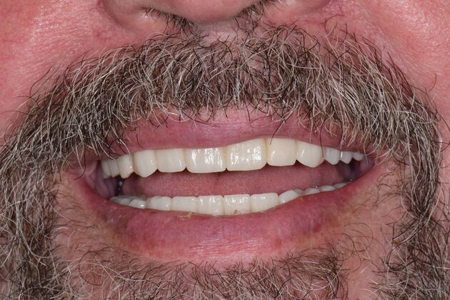 Before and Afters  Case 10 - After