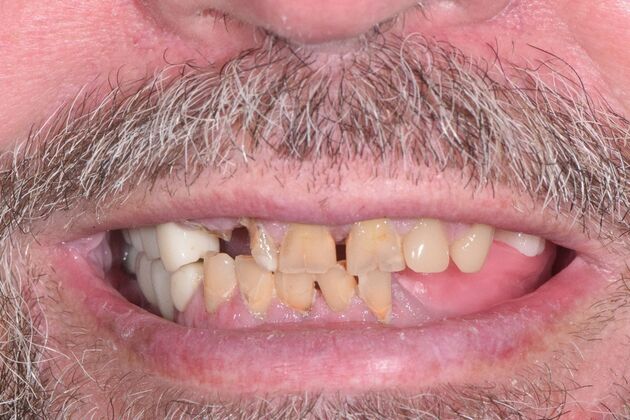 Before and Afters  Case 10 - Before