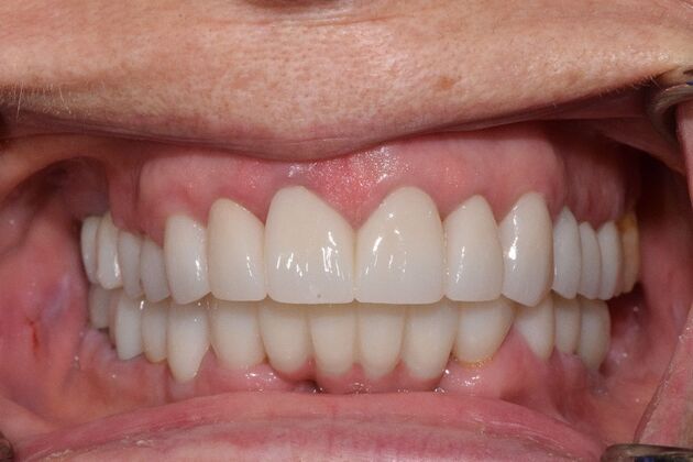 Before and Afters : Case 11 - After