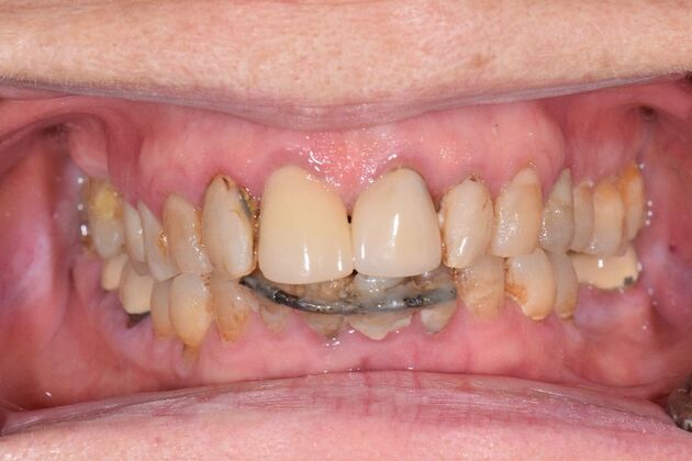 Before and Afters : Case 11 - Before