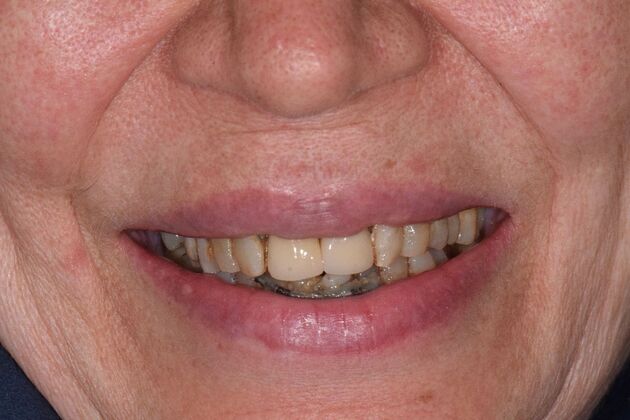 Before and Afters  Case 11 - Before