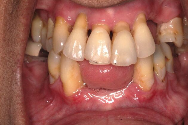 Before and Afters : Case 12 - Before