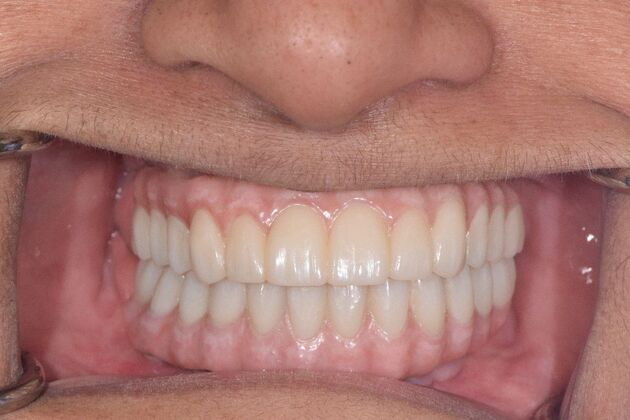 Before and Afters : Case 12 - After