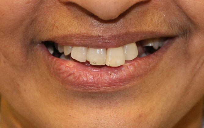 Before and Afters  Case 12 - Before