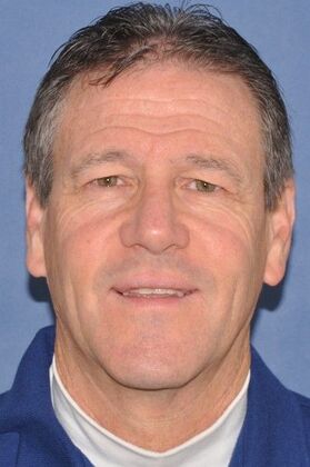 Rhinoplasty Crooked nose with a bump in a man - After