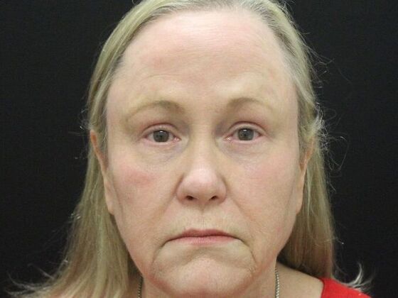 Non-Surgical Case 19 - After