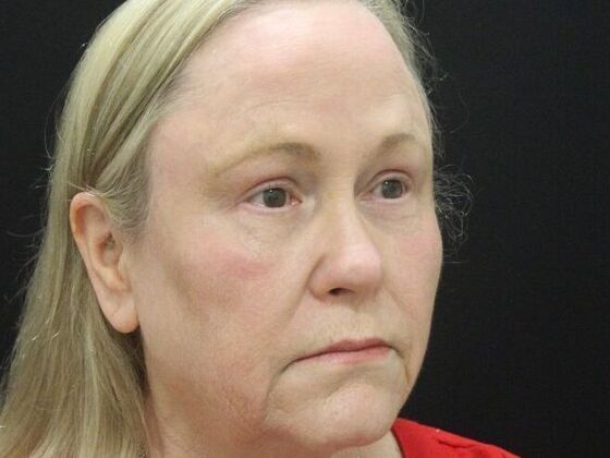 Non-Surgical: Case 19 - After