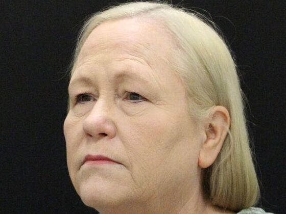 Non-Surgical: Case 19 - Before