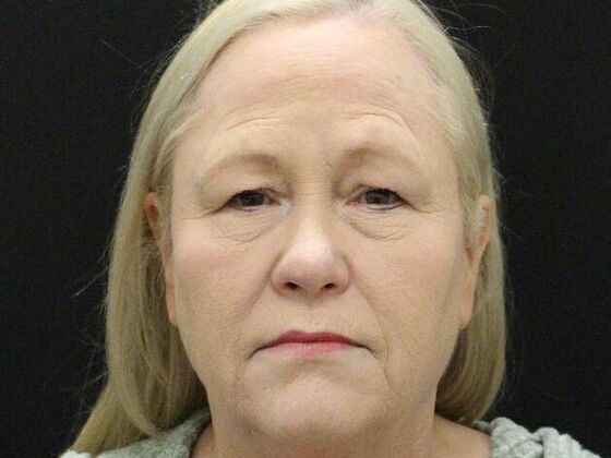 Non-Surgical Case 19 - Before