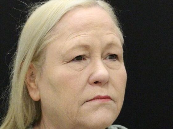 Non-Surgical: Case 19 - Before