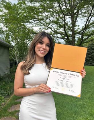 Rhinoplasty Lovely patient 4 years after surgery