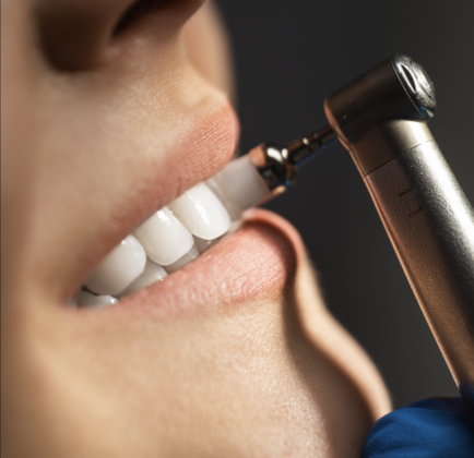 Dental Cleaning Case