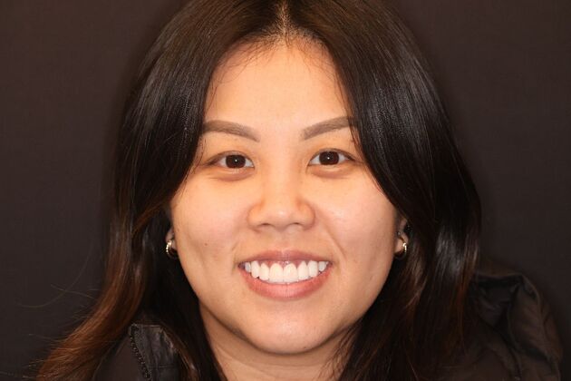 Smile Makeover: Case 3 - After