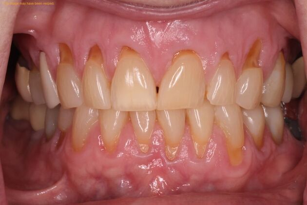 Smile Makeover: Case 3 - Before