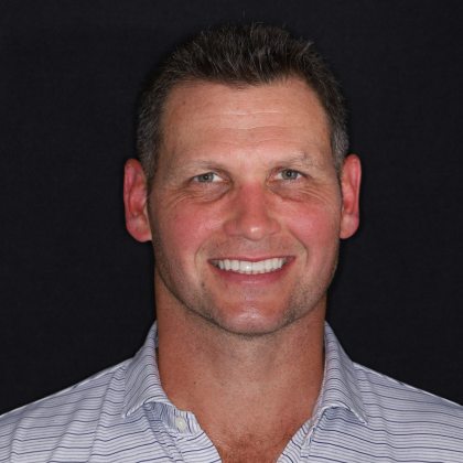 No Prep Porcelain Veneers Sean - After