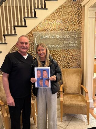 Rhinoplasty: Beautiful result in bump, crooked and blocked breathing - Before and after 1 year