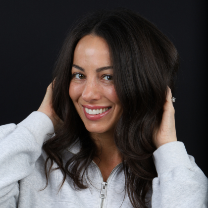 Minimal Prep Porcelain Veneers Jamie - After