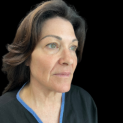 Face & Neck Lifts: Case 1 - Before