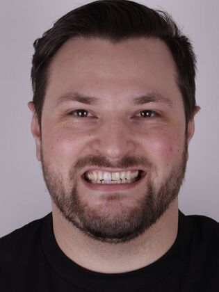 Smile Transformations: Case 1 - Before