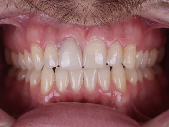 Smile Transformations Case 1 - Before