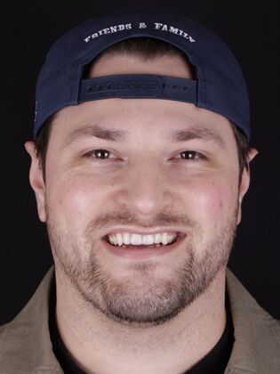 Smile Transformations: Case 1 - After