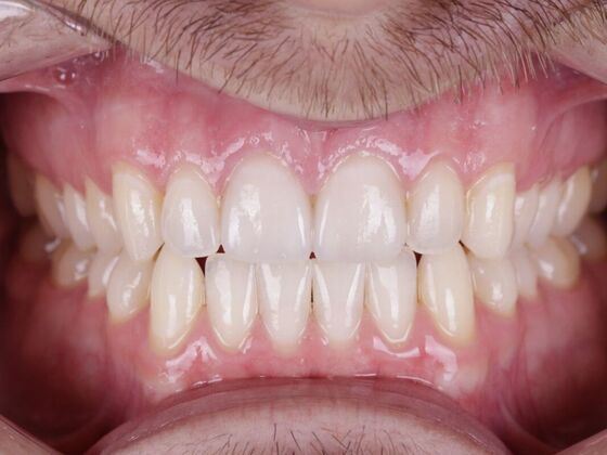 Smile Transformations Cases