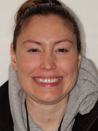 Smile Transformations: Case 2 - Before