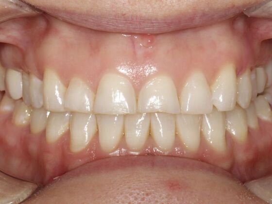 Smile Transformations Case 2 - Before