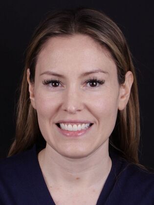 Smile Transformations: Case 2 - After