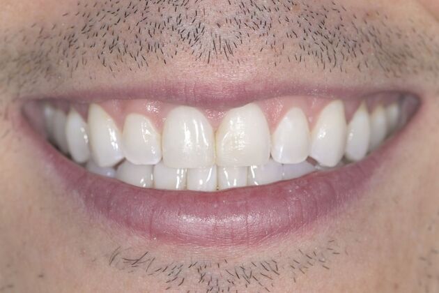 Smile Transformations Case 3 - Before