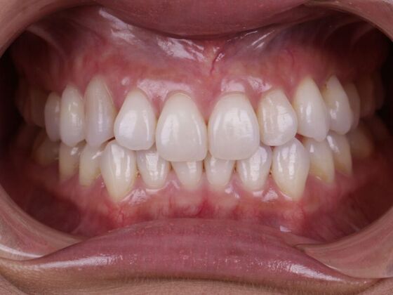 Smile Transformations Case 5 - Before
