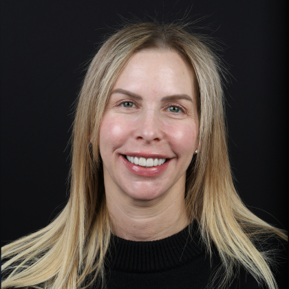 SmileSculpt Veneers Tracy - After