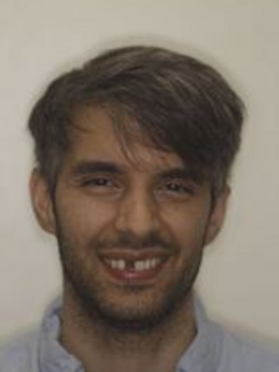 Smile Transformations: Case 7 - Before