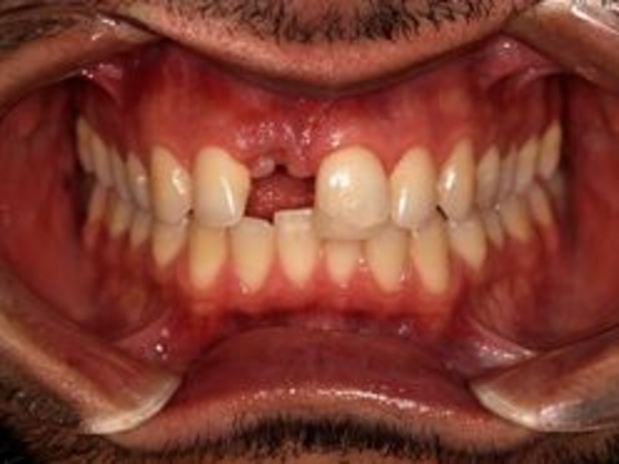 Smile Transformations Case 7 - Before