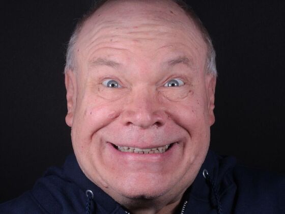 Zirconia Crowns: Case 12 - After