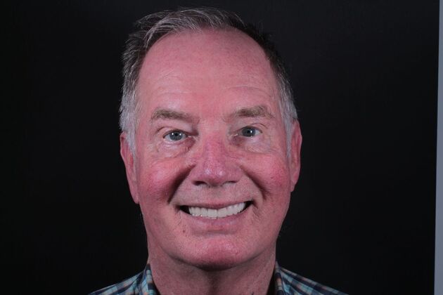 Removable Dentures: Case 22 - After