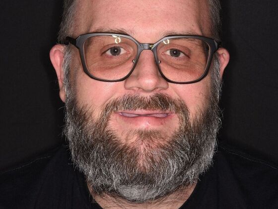 All on 4 (Full Arch Implant Cases) Case 25 - Before