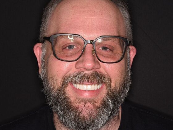 All on 4 (Full Arch Implant Cases) Case 25 - After