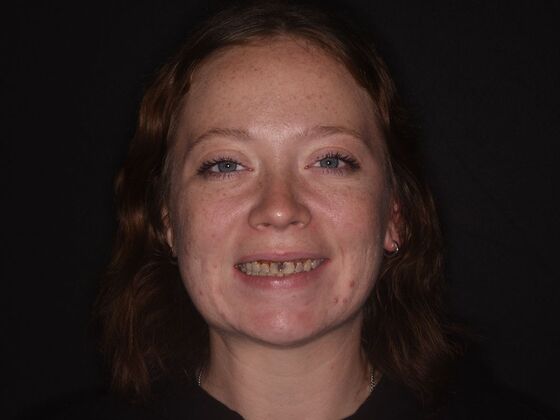 Cosmetic Dentistry Case 3 - Before