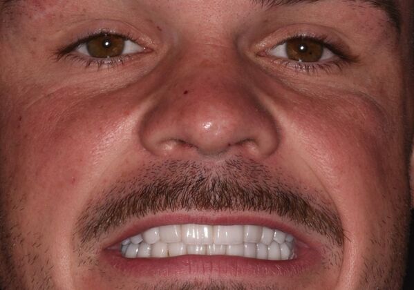 Cosmetic Dentistry Case 9 - After