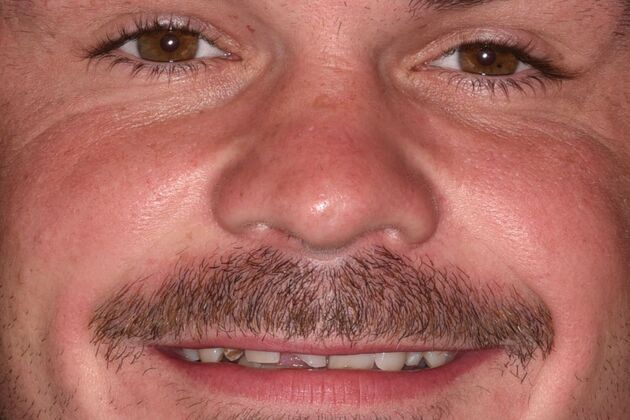 Cosmetic Dentistry Case 9 - Before