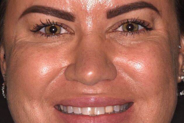 Cosmetic Dentistry Case 10 - Before