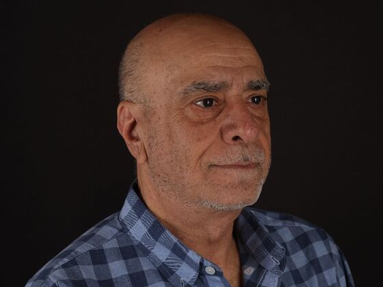 Face & Neck Lifts: Case 6 - After