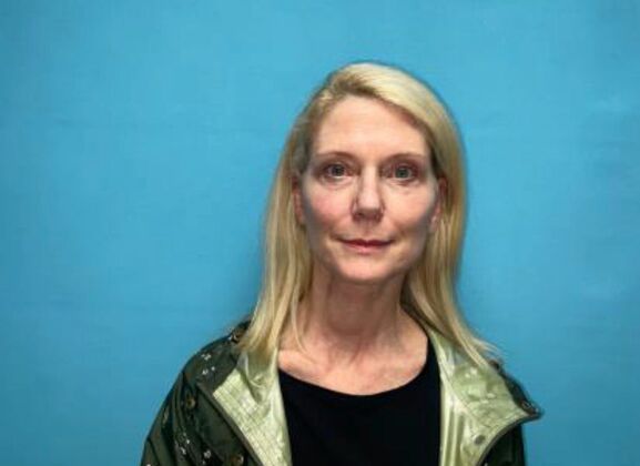 Facelift Case 21 - After