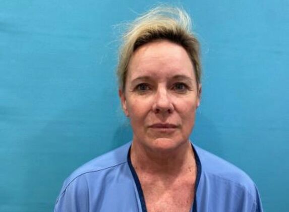 Facelift Case 22 - Before