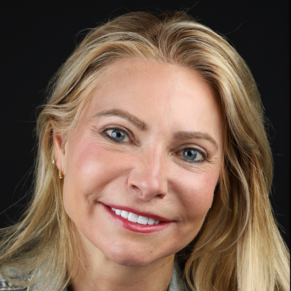 No Prep Porcelain Veneers Tracey - After