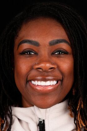 Full Mouth Restoration Jasmine  - After