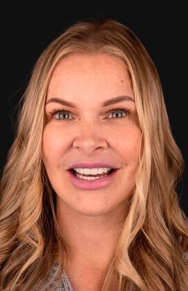 Full Mouth Restoration Beca - After