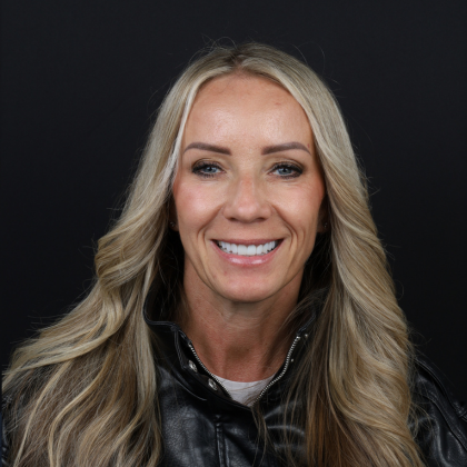 Minimal Prep Porcelain Veneers Sylvia - After