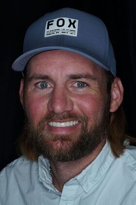 Before and After Case 16 - After